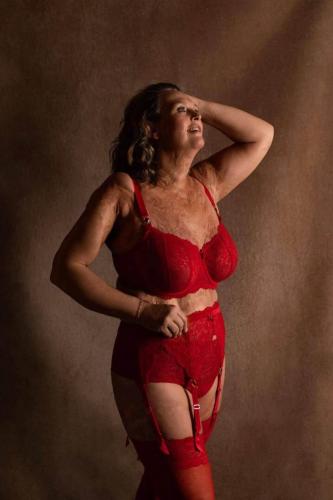 Boudoirfotoshoot van vrouw met littekens in Arnhem
